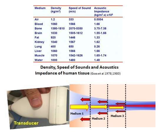 Interaction of Sound Waves With Tissue